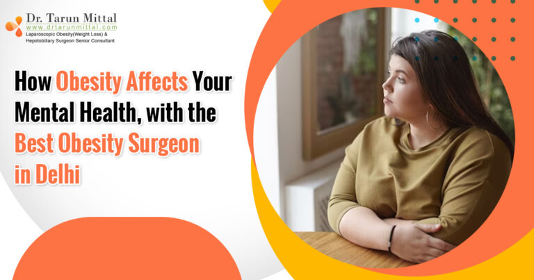 Best Obesity Surgeon in Delhi