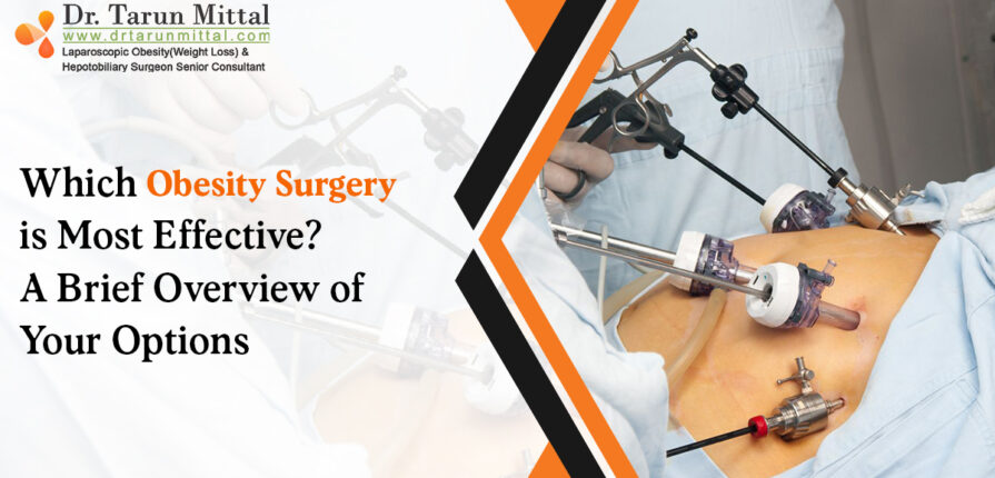 Which Obesity Surgery is Best