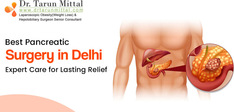 pancreatic surgeon in delhi