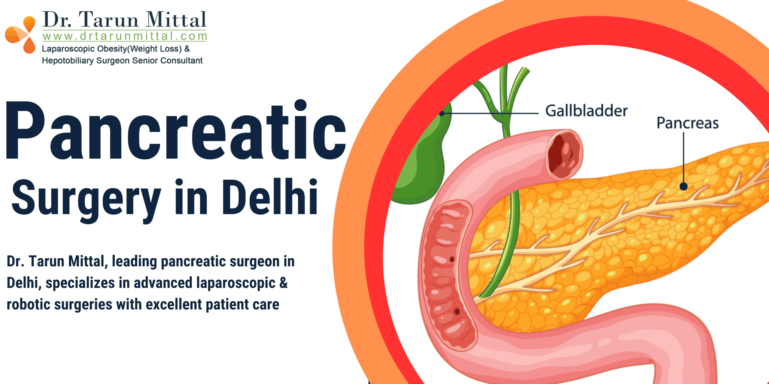Best Pancreatic surgery in Delhi