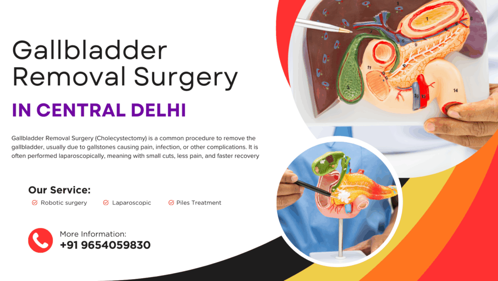 Gallbladder Removal Surgery in Central Delhi - Dr. Tarun Mittal