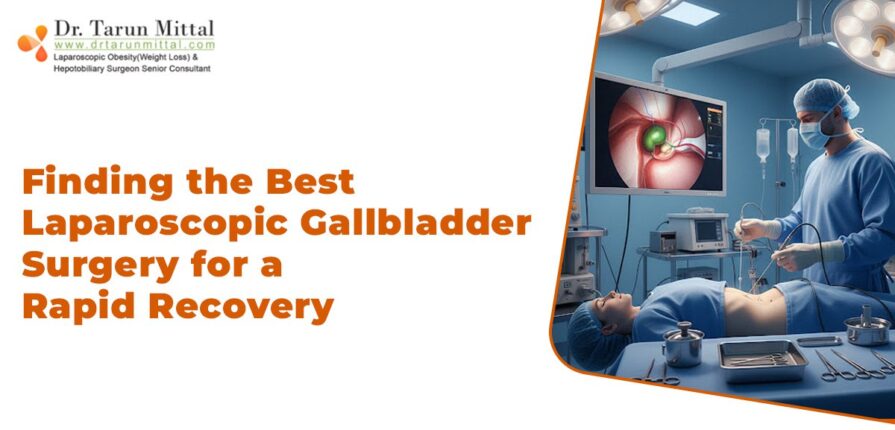 Best Laparoscopic surgery recovery in Delhi