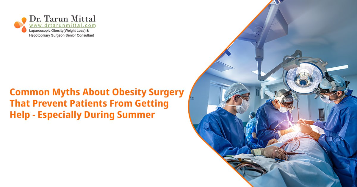 Common myths about obesity surgery during summer